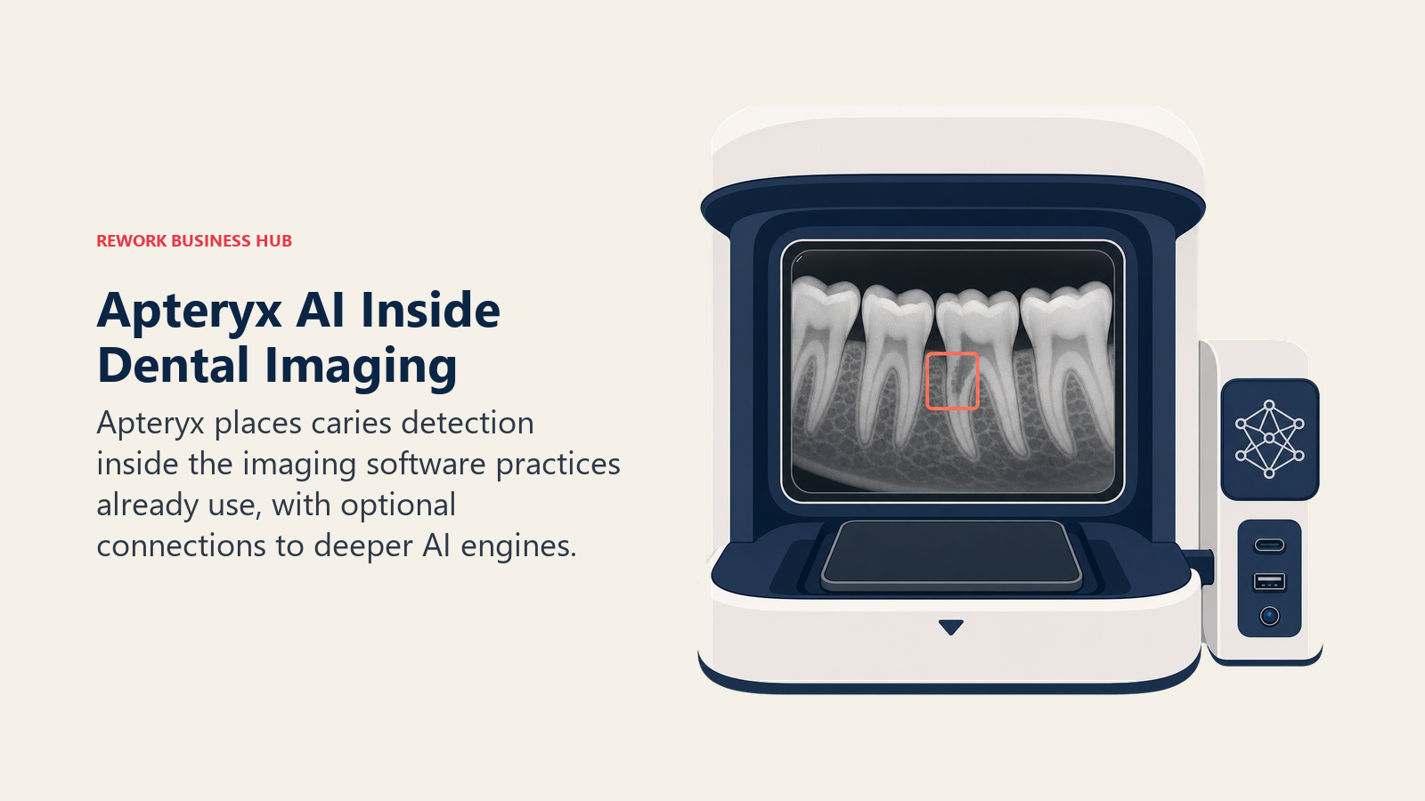 Apteryx dental imaging AI shown as native caries detection inside the X-ray capture workflow with an extension dock